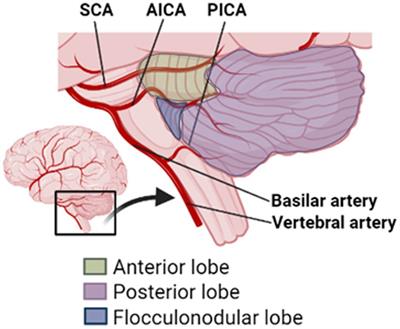 Frontiers Neuropsychiatric Outcomes Following Strokes Involving The